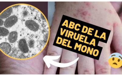 ABC de la viruela del mono